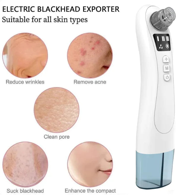 Frost Glow Clear Skin Electric Blackhead Remover